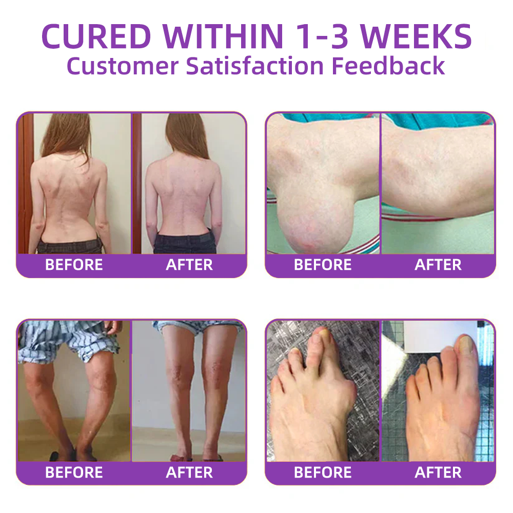 𝐎𝐟𝐟𝐢𝐜𝐢𝐚𝐥 𝐒𝐭𝐨𝐫𝐞: 𝐓𝐋𝐎𝐏𝐀® 𝑺𝒉𝒂𝒓𝒌 𝑪𝒂𝒓𝒕𝒊𝒍𝒂𝒈𝒆 𝑷𝒂𝒊𝒏-𝑺𝒐𝒐𝒕𝒉𝒊𝒏𝒈 𝑩𝒐𝒏𝒆 𝑹𝒆𝒄𝒐𝒗𝒆𝒓𝒚 𝑮𝒆𝒍 👨‍⚕️𝑨𝒎𝒆𝒓𝒊𝒄𝒂𝒏 𝑨𝒄𝒂𝒅𝒆𝒎𝒚 𝒐𝒇 𝑶𝒓𝒕𝒉𝒐𝒑𝒂𝒆𝒅𝒊𝒄 𝑺𝒖𝒓𝒈𝒆𝒐𝒏𝒔 (𝑨𝑨𝑶𝑺) 𝒓𝒆𝒄𝒐𝒎𝒎𝒆𝒏𝒅 (5-𝗆𝗂𝗇𝗎𝗍𝖾 𝗉𝖺𝗂𝗇 𝗋𝖾𝗅𝗂𝖾𝖿, 𝟩 𝖽𝖺𝗒𝗌 𝗍𝗈 𝗋𝖾𝗌𝗍𝗈𝗋𝖾 𝗃𝗈𝗂𝗇𝗍 𝗆𝗈𝖻𝗂𝗅𝗂𝗍𝗒, 𝟦 𝗐𝖾𝖾𝗄𝗌 𝖿𝗈𝗋 𝖼𝗈𝗆𝗉𝗅𝖾𝗍𝖾 𝗁𝖾𝖺𝗅𝗂𝗇𝗀)🔥